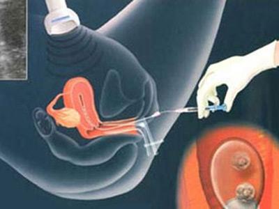 Làm thế nào bạn nữ bạn nên cải thiện chất lượng của trứng? Sản phẩm đậu nành có thể làm cho trứng khỏe mạnh hơn?