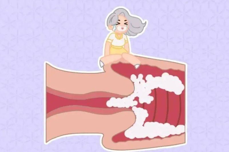 Làm thế nào để ngừng uống thuốc tránh thai hoạt động lâu dài? Các biện pháp phòng ngừa cho thuốc tránh thai hoạt động lâu dài là gì