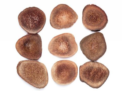 Tôi nên làm gì nếu một người đàn ông có áp xe? Các thành phần để bổ sung bản chất là gì